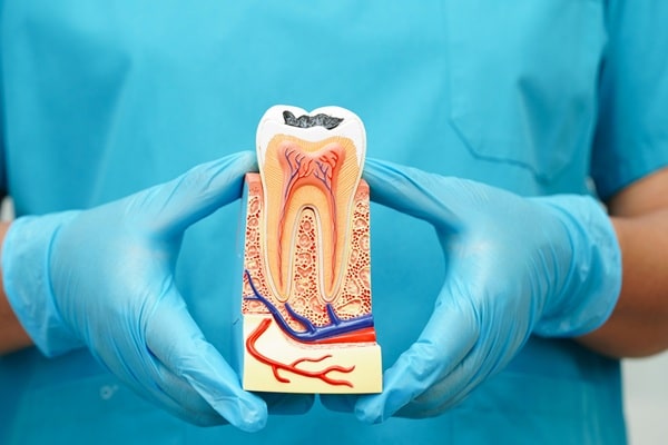 root-canals-empire-dental