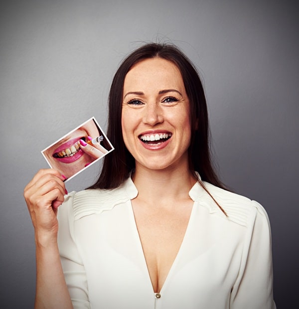 whats-included-in-an-oral-cancer-screening